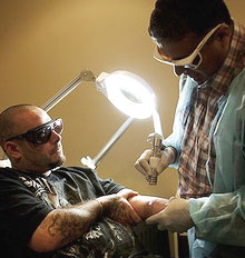 Laser Cosmetics Doctors Tattoo Removal