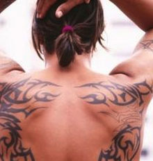 Tattoo Removal Techniques