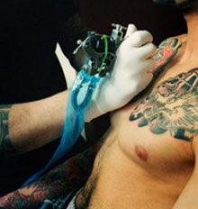 Risks of Tattoo Removal