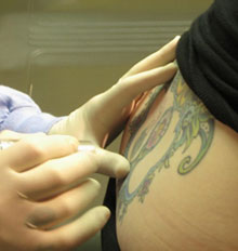 Taking Care After Tattoo Removal