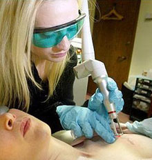 Tattoo Removal on the NHS