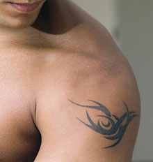 Tattoo Removal Reviews