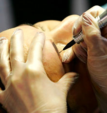 Tattoo Removal Semi Permanent Make Up